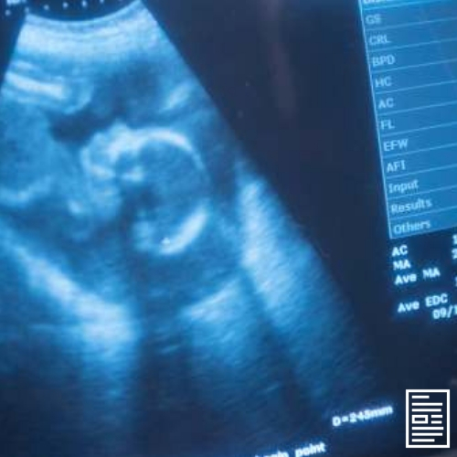 How Science, Sonograms, Scripture Confirm Unborn Babies Are Not Mere ‘Blobs’