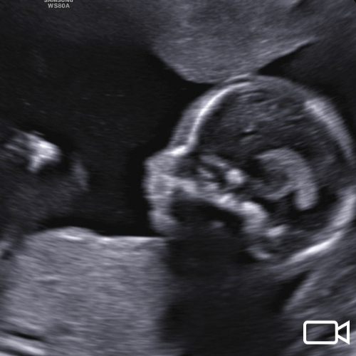 It’s Time to Reverse Roe v. Wade